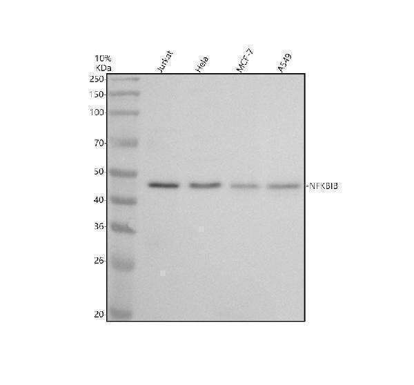 Anti-IKB beta Rabbit Monoclonal Antibody