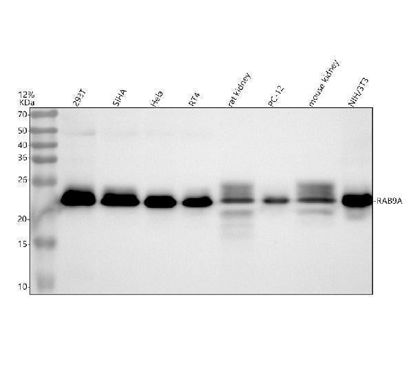 Anti-Rab9 RAB9A Rabbit Monoclonal Antibody