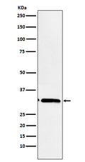 Western blot analysis of EB3 expression in Ratmuscle cell lysate.