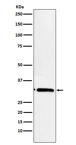 Western blot analysis of EB3 expression in Ratmuscle cell lysate.