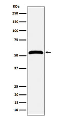 Western blot analysis of MPP1 expression in Jurkat cell lysate.