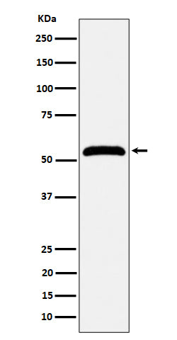 Western blot analysis of MPP1 expression in Jurkat cell lysate.