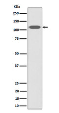 Western blot analysis of ZHX2 expression in HeLa cell lysate.