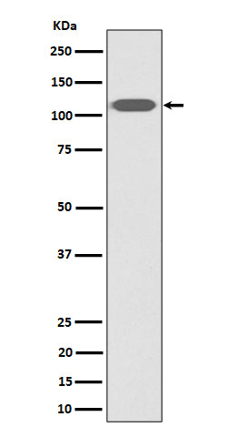 Western blot analysis of ZHX2 expression in HeLa cell lysate.