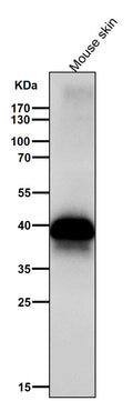 All lanes use the Antibody at 1:2K dilution for 1 hour at room temperature.