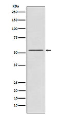 Western blot analysis of P70 S6 Kinase beta expression in K562 cell lysate.