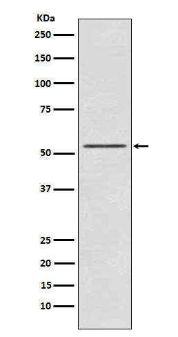 Western blot analysis of P70 S6 Kinase beta expression in K562 cell lysate.
