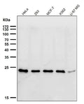 All lanes use the Antibody at 1:1K dilution for 1 hour at room temperature.