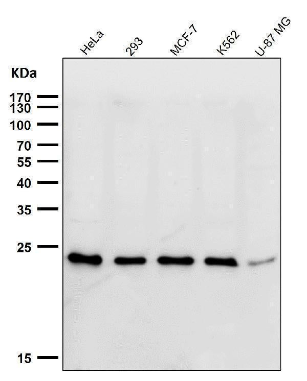 All lanes use the Antibody at 1:1K dilution for 1 hour at room temperature.