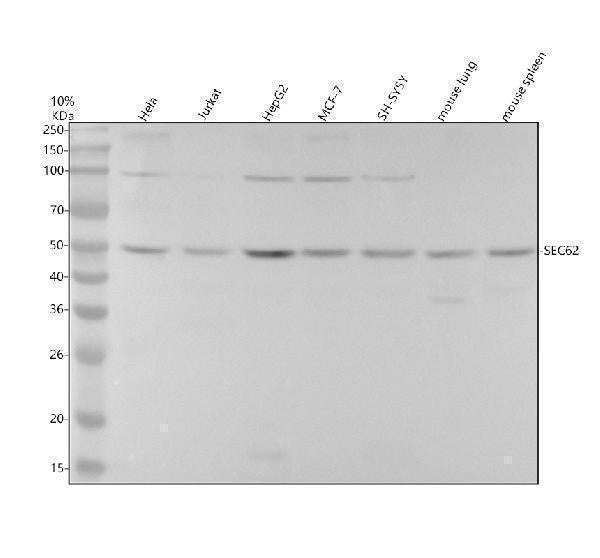 Anti-SEC62 Rabbit Monoclonal Antibody