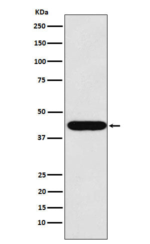 Western blot analysis of LHX2 expression in HeLa cell lysate.