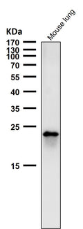All lanes use the Antibody at 1:2K dilution for 1 hour at room temperature.