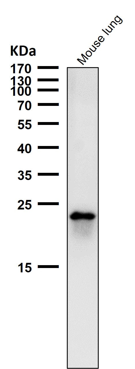 All lanes use the Antibody at 1:2K dilution for 1 hour at room temperature.