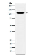 Western blot analysis of GPCR / LGR6 expression in HUVEC cell lysate.