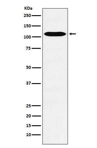 Western blot analysis of GPCR / LGR6 expression in HUVEC cell lysate.