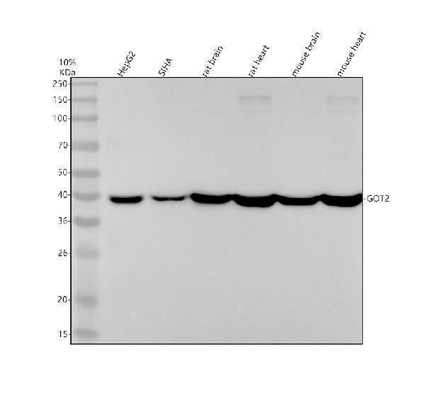 Anti-GOT2 Rabbit Monoclonal Antibody