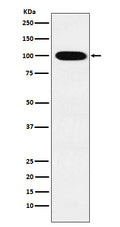 Western blot analysis of VPS18  expression in K562 cell lysate.