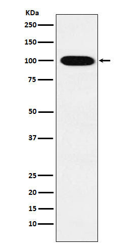 Western blot analysis of VPS18  expression in K562 cell lysate.