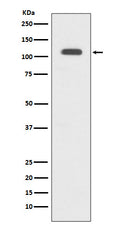 Western blot analysis of GART expression in HeLa cell lysate.