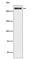 Western blot analysis of Talin 2 in expression HeLa cell lysate.