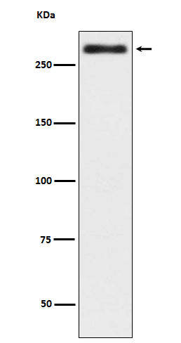 Western blot analysis of Talin 2 in expression HeLa cell lysate.