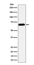 Western blot analysis of intestinal alkaline phosphatase expression in HeLa cell lysate.