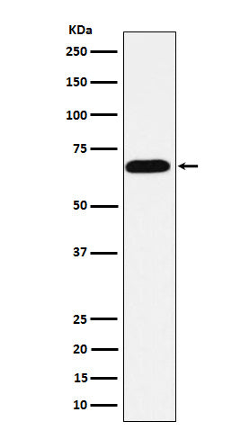 Western blot analysis of intestinal alkaline phosphatase expression in HeLa cell lysate.