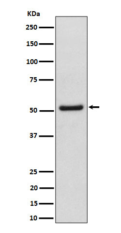 Western blot analysis of NUP50 expression in HeLa cell lysate.