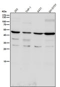 All lanes use the Antibody at 1:6K dilution for 1 hour at room temperature.