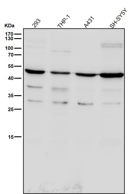 All lanes use the Antibody at 1:6K dilution for 1 hour at room temperature.