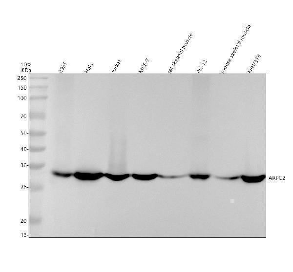 Anti-ARPC2 Rabbit Monoclonal Antibody