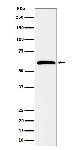 Western blot analysis of Syndecan 3 expression in K562 cell lysate.