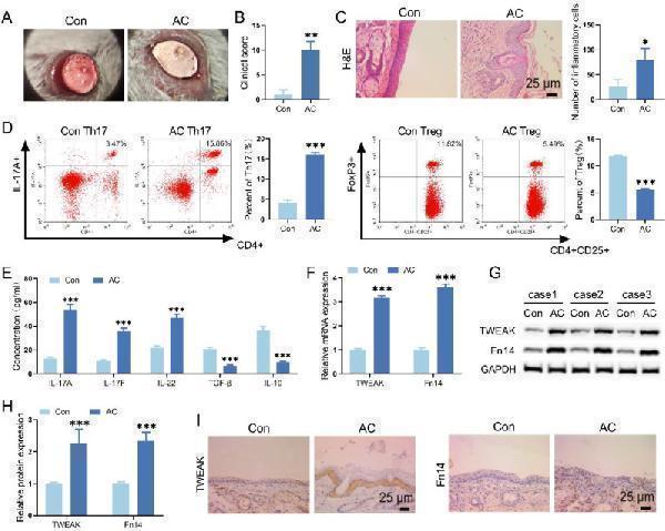 Anti-TWEAKR Rabbit Monoclonal Antibody