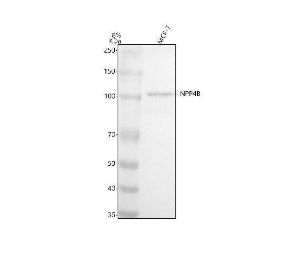 Anti-INPP4B/Type Ii 4 Phosphatase Rabbit Monoclonal Antibody