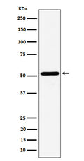 Western blot analysis of NPY5R expression in Ramos cell lysate.