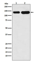 Western blot analysis of K Cadherin expression in (1) Jurkat cell lysate; (2) Mouse heart lysate.