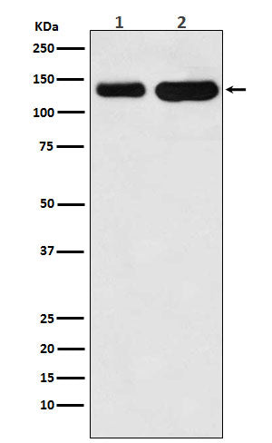 Western blot analysis of K Cadherin expression in (1) Jurkat cell lysate; (2) Mouse heart lysate.
