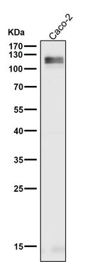 All lanes use the Antibody at 1:1K dilution for 1 hour at room temperature.