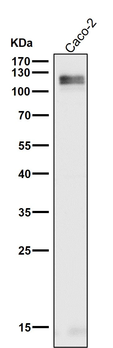 All lanes use the Antibody at 1:1K dilution for 1 hour at room temperature.