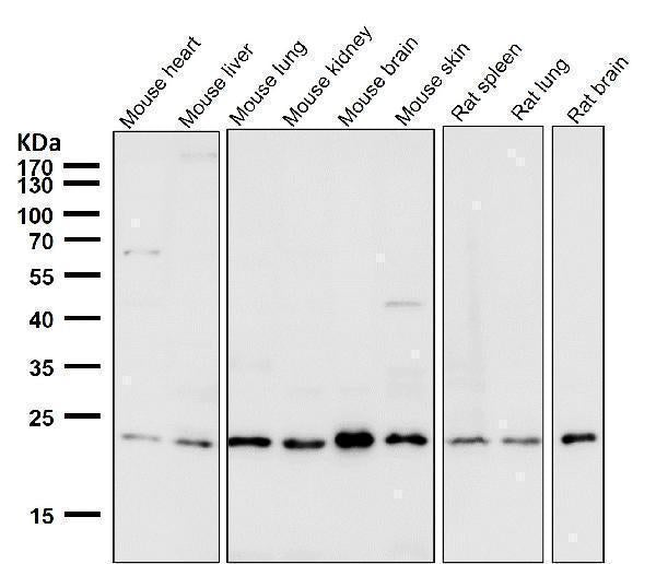 All lanes use the Antibody at 1:2K dilution for 1 hour at room temperature.