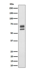 Western blot analysis of PPP2R5D expression in HeLa cell lysate.