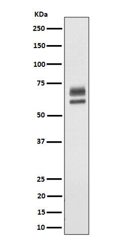 Western blot analysis of PPP2R5D expression in HeLa cell lysate.