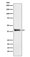 Western blot analysis of Alcohol Dehydrogenase expression in HepG2 cell lysate.