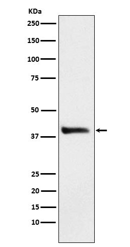 Western blot analysis of Alcohol Dehydrogenase expression in HepG2 cell lysate.