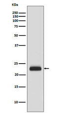 Western blot analysis of RAIDD expression in HeLa cell lysate.
