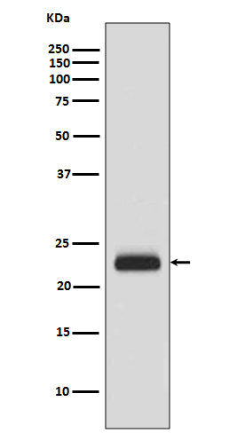Western blot analysis of RAIDD expression in HeLa cell lysate.
