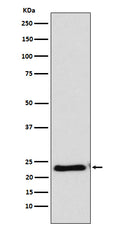 Western blot analysis of RAIDD expression in HeLa cell lysate.