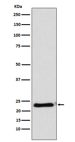 Western blot analysis of RAIDD expression in HeLa cell lysate.