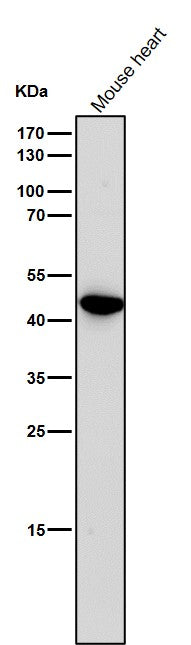 All lanes use the Antibody at 1:1K dilution for 1 hour at room temperature.