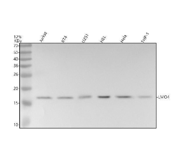 Anti-LMO4 Rabbit Monoclonal Antibody